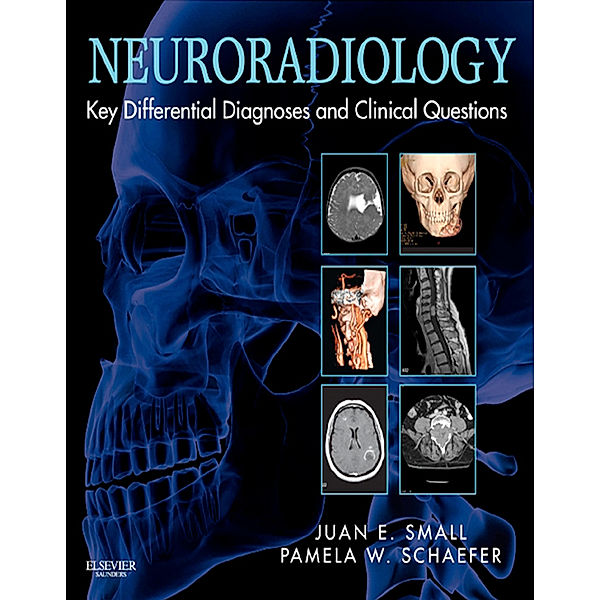 Neuroradiology: Key Differential Diagnoses and Clinical Questions E-Book, Pamela W. Schaefer, Juan E. Small