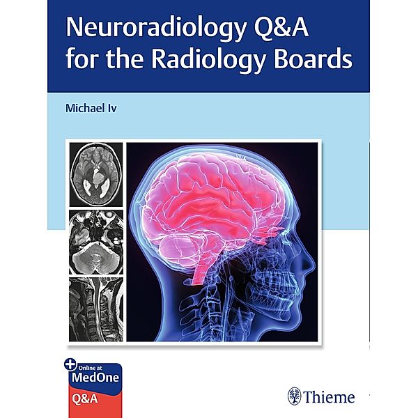 Neuroradiology Q&A for the Radiology Boards, Michael Iv