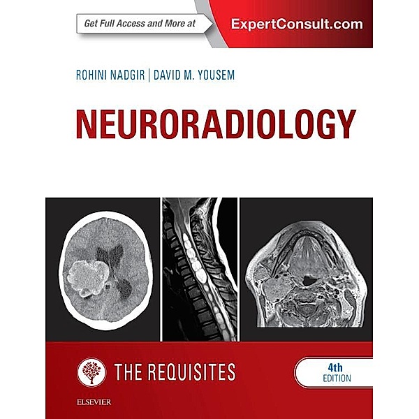 Neuroradiology: The Requisites E-Book, Rohini Nadgir, David M. Yousem