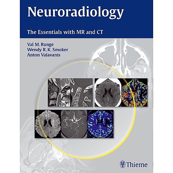 Neuroradiology / Thieme, Anton Valavanis, Val M. Runge, Wendy R. K. Smoker