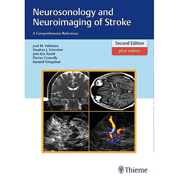 Neurosonology and Neuroimaging of Stroke, José Manuel Valdueza, Stephan Schreiber, Jens-Eric Röhl, Florian Connolly, Randolf Klingebiel
