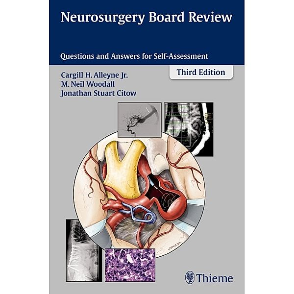 Neurosurgery Board Review