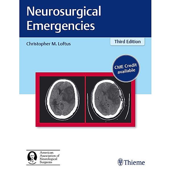 Neurosurgical Emergencies