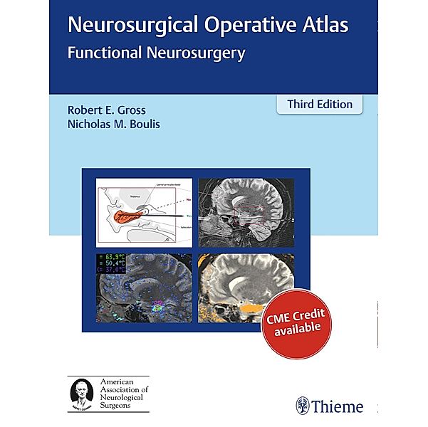 Neurosurgical Operative Atlas