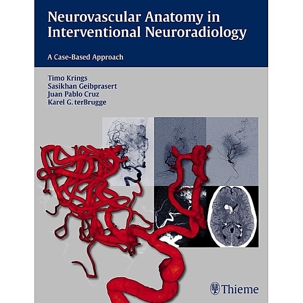 Neurovascular Anatomy in Interventional Neuroradiology, Juan Pablo Cruz, Karel ter Brugge