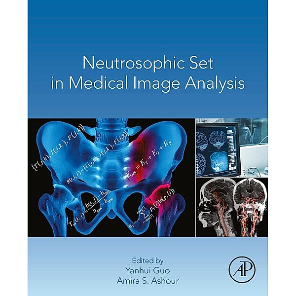 Neutrosophic Set in Medical Image Analysis