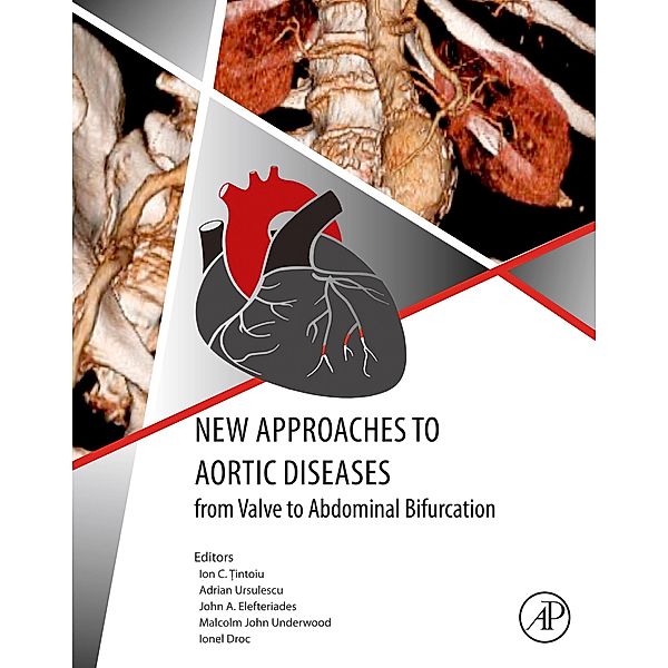 New Approaches to Aortic Diseases from Valve to Abdominal Bifurcation