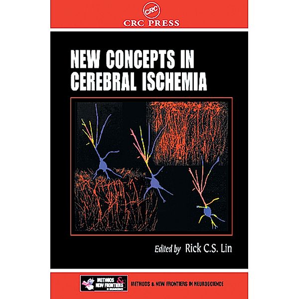 New Concepts in Cerebral Ischemia