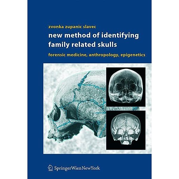 New Method of Identifying Family Related Skulls, Zvonka Zupanic Slavec