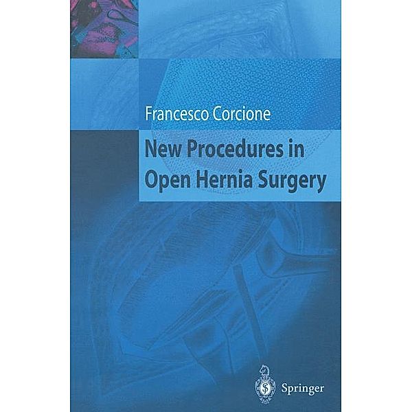 New Procedures in Open Hernia Surgery, Francesco Corcione