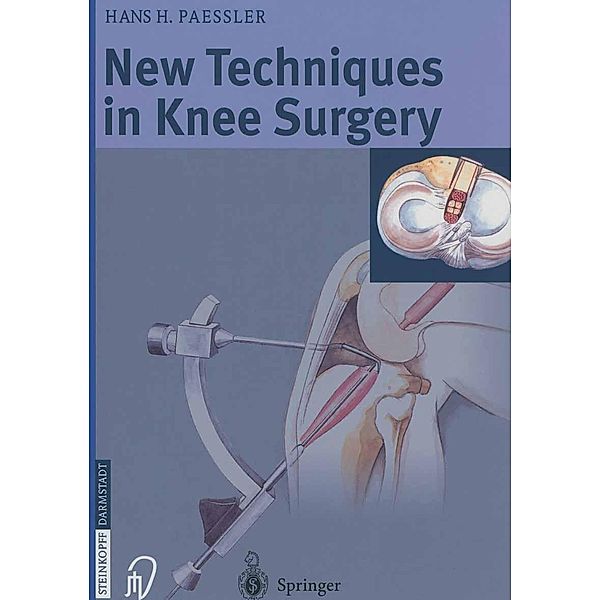 New Techniques in Knee Surgery, H. H. Paessler