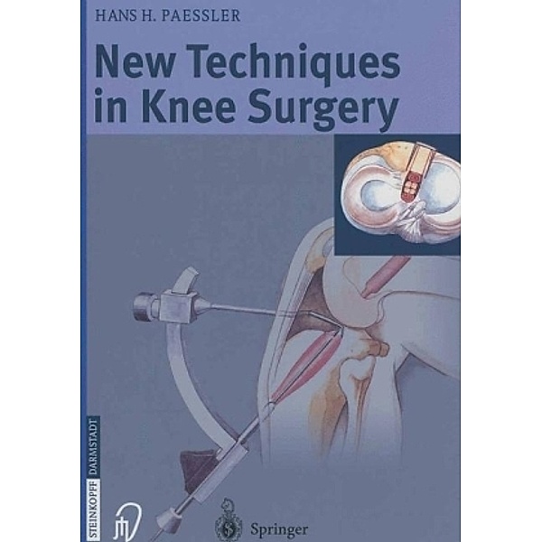 New Techniques in Knee Surgery, Hans H. Pässler