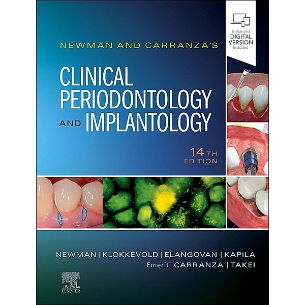Newman and Carranza's Clinical Periodontology and Implantology, Michael G. Newman, Perry R. Klokkevold, Satheesh Elangovan, Yvonne Kapila