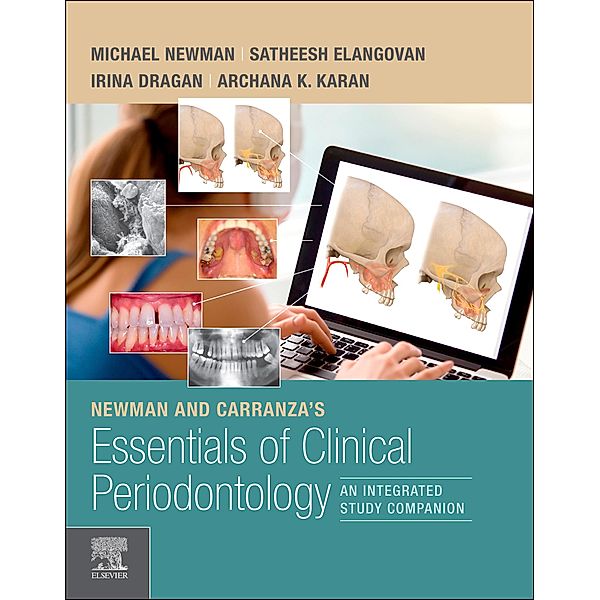 Newman and Carranza's Essentials of Clinical Periodontology E-Book