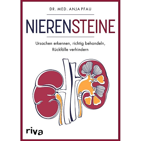 Nierensteine - Ursachen erkennen, richtig behandeln, Rückfälle verhindern, Anja Pfau