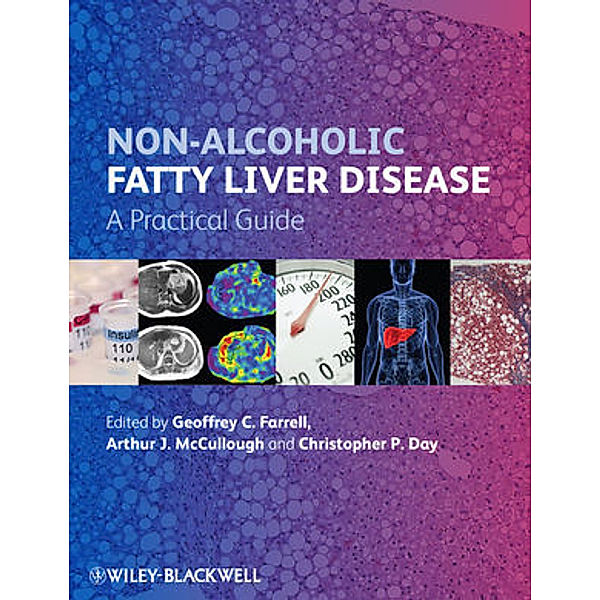 Non-Alcoholic Fatty Liver Disease