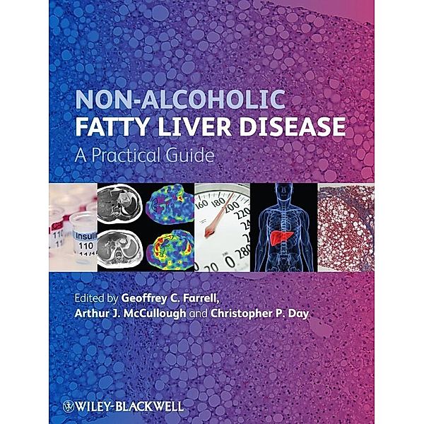 Non-Alcoholic Fatty Liver Disease