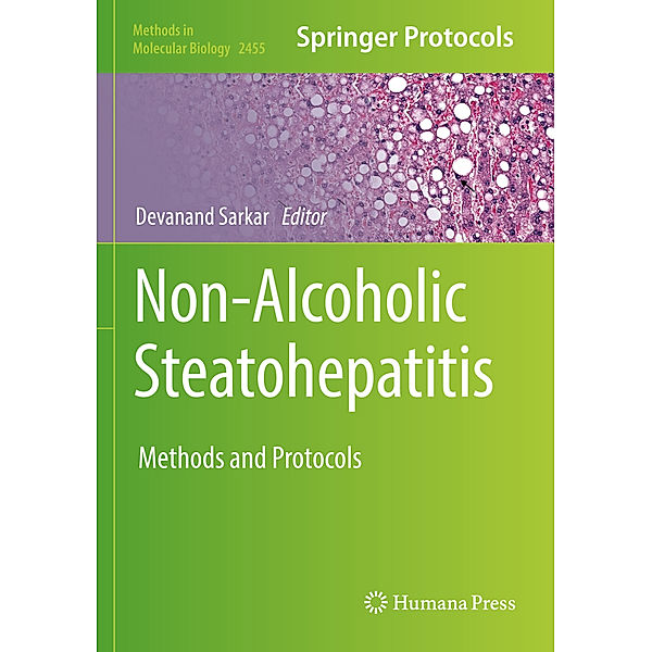 Non-Alcoholic Steatohepatitis