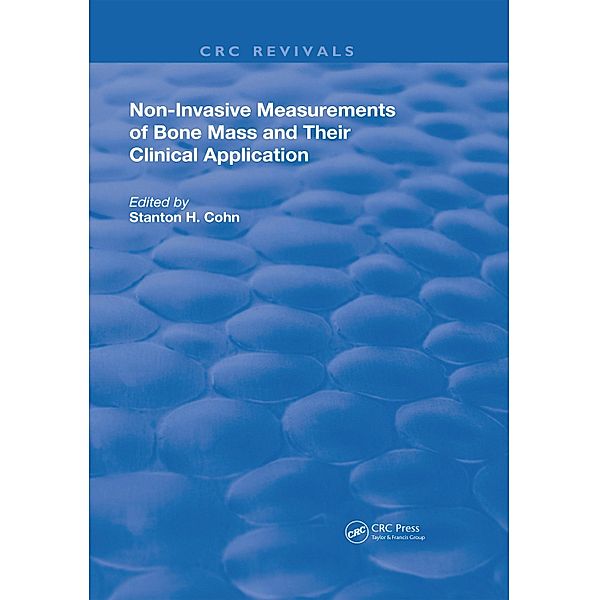 Non-Invasive Measurements of Bone Mass & Their Clinical Application