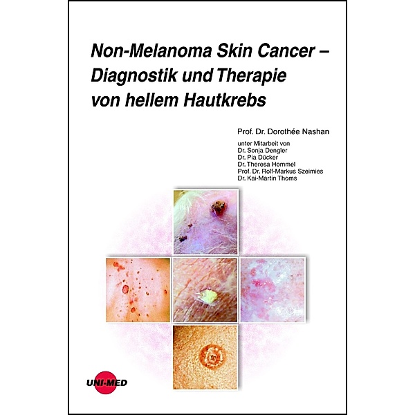 Non-Melanoma Skin Cancer - Diagnostik und Therapie von hellem Hautkrebs / UNI-MED Science, Dorothée Nashan