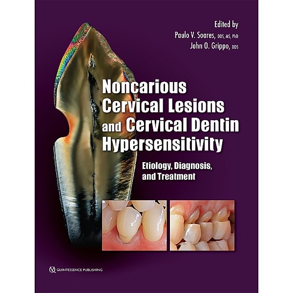 Noncarious Cervical Lesions and Cervical Dentin Hypersensitivity, Paulo V. Soares, John O. Grippo