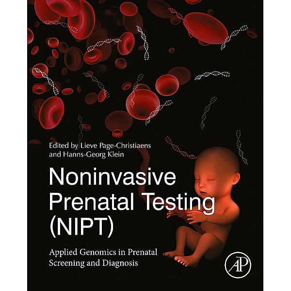 Noninvasive Prenatal Testing (NIPT)