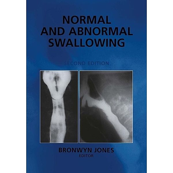 Normal and Abnormal Swallowing