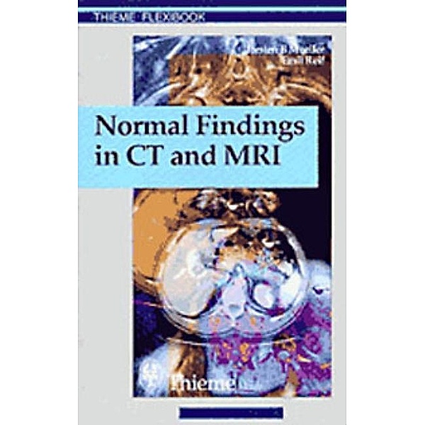Normal Findings in CT and MRI, Torsten B. Möller, Emil Reif