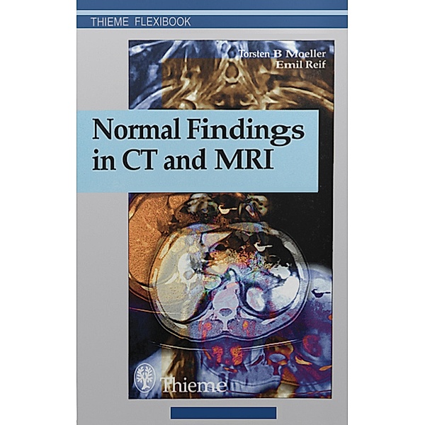 Normal Findings in CT and MRI, Torsten Bert Moeller, Emil Reif
