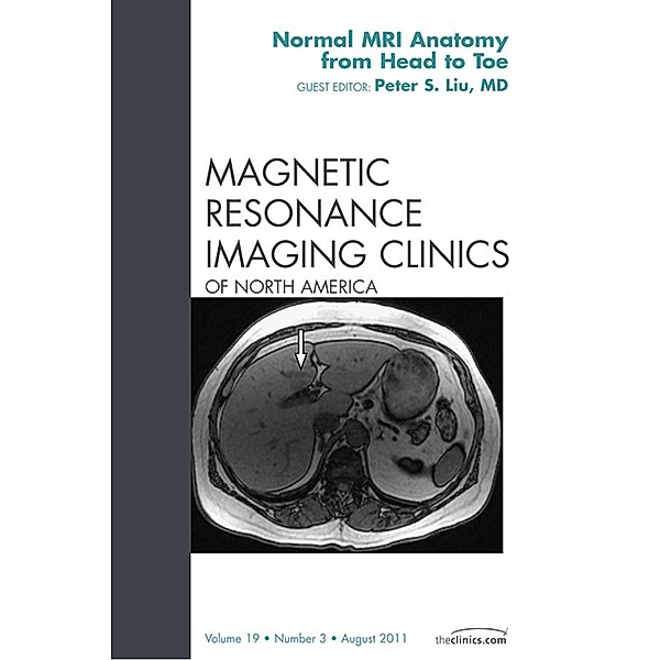 Normal MR Anatomy, An Issue of Magnetic Resonance Imaging Clinics, Peter S. Liu