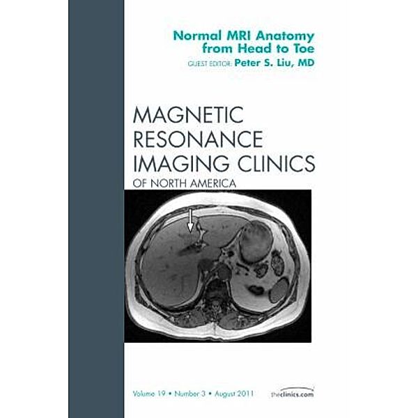 Normal MR Anatomy from Head to Toe, An Issue of Magnetic Resonance Imaging Clinics, Peter Liu, Peter S. Liu