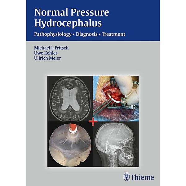 Normal Pressure Hydrocephalus, Michael J. Fritsch, Ullrich Meier, Uwe Kehler