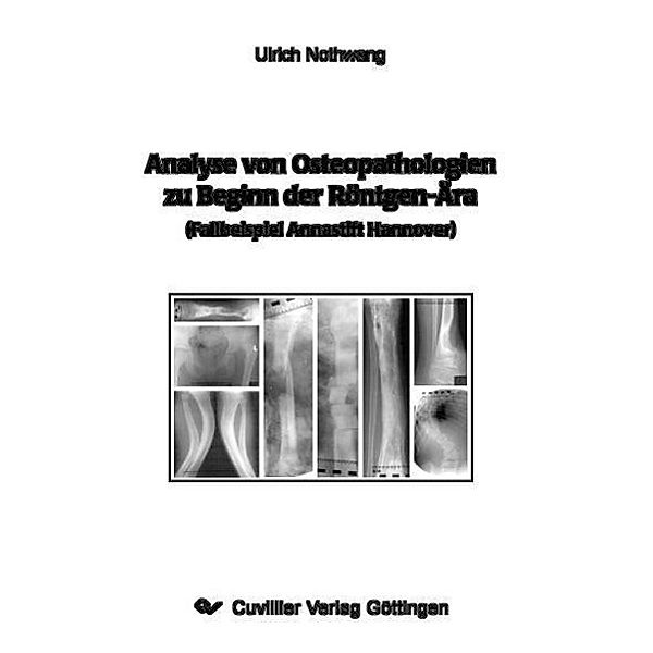 Nothwang, U: Analyse von Osteopathologien, Ulrich Nothwang
