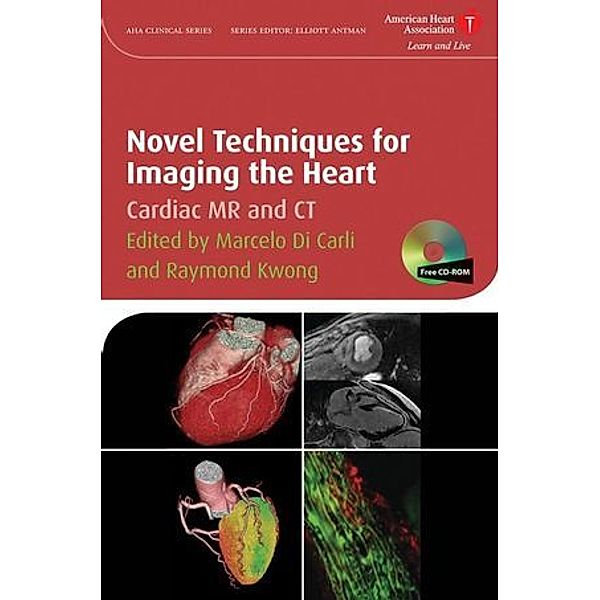 Novel Techniques for Imaging the Heart, Marcelo F. Di Carli, Raymond Y. Kwong