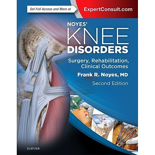 Noyes' Knee Disorders, Frank R. Noyes