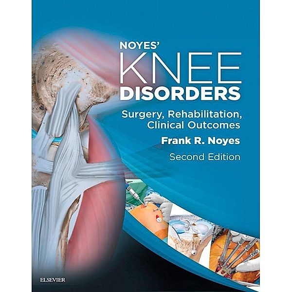 Noyes' Knee Disorders: Surgery, Rehabilitation, Clinical Outcomes E-Book, Frank R. Noyes