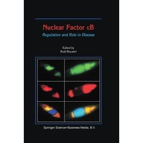 Nuclear Factor ¿B
