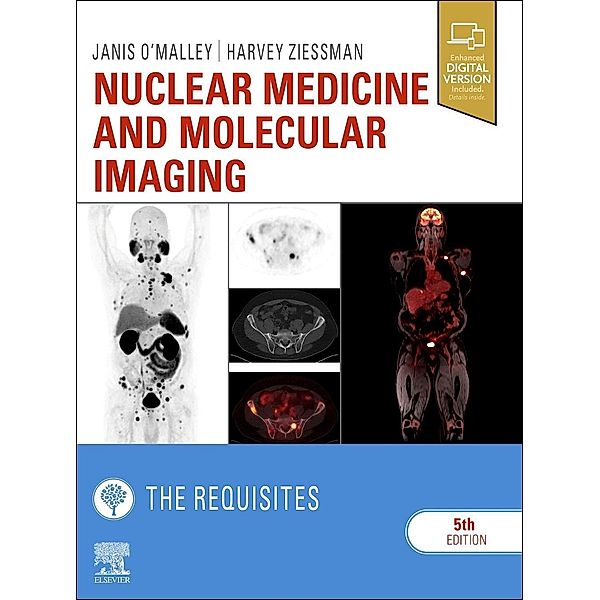 Nuclear Medicine and Molecular Imaging: The Requisites, Janis P. O'Malley, Harvey A. Ziessman