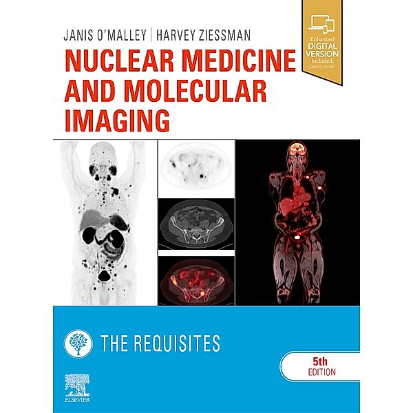 Nuclear Medicine and Molecular Imaging: The Requisites E-Book, Janis P. O'Malley, Harvey A. Ziessman