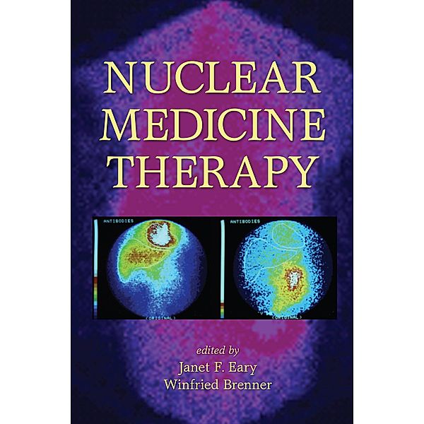 Nuclear Medicine Therapy