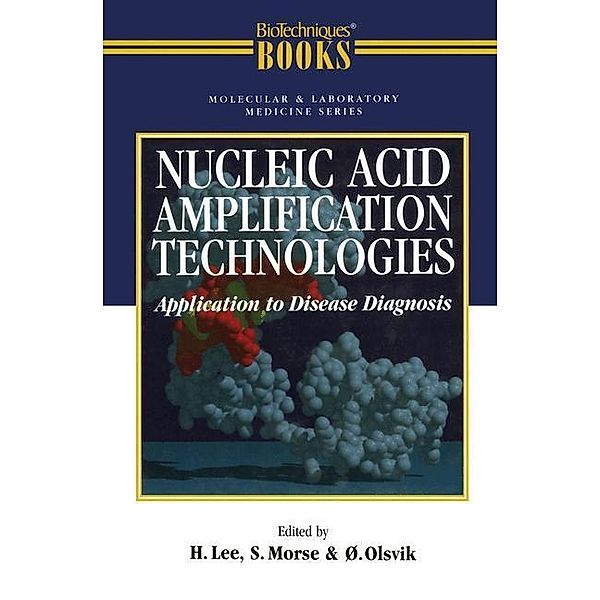 Nucleic Acid Amplification Technologies: Application to Disease Diagnosis
