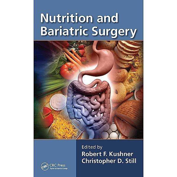 Nutrition and Bariatric Surgery