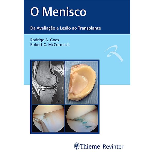 O Menisco, Rodrigo A. Goes, Robert G. McCormack