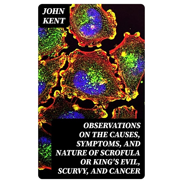 Observations on the Causes, Symptoms, and Nature of Scrofula or King's Evil, Scurvy, and Cancer, John Kent