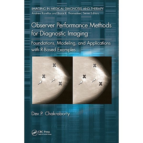 Observer Performance Methods for Diagnostic Imaging, Dev P. Chakraborty