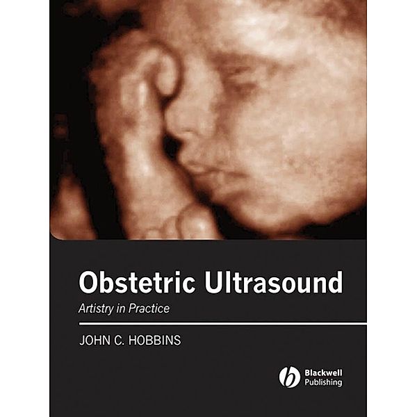 Obstetric Ultrasound, John C. Hobbins