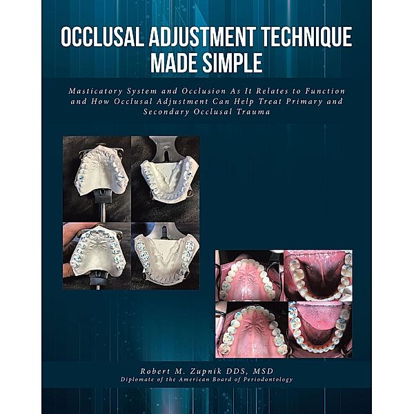 Occlusal Adjustment Technique Made Simple, Robert M. Zupnik DDS MSD Diplomate of the American Board of Periodontology