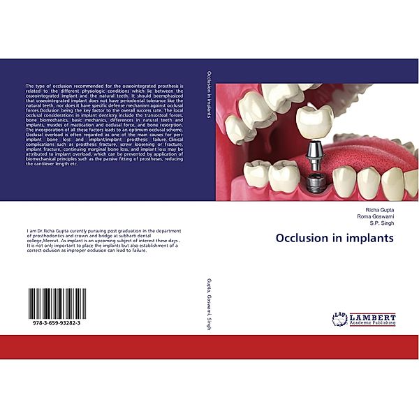 Occlusion in implants, Richa Gupta, Roma Goswami, S. P. Singh