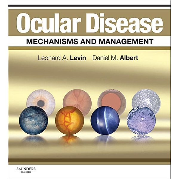 Ocular Disease: Mechanisms and Management E-Book, Leonard A Levin, Daniel M. Albert