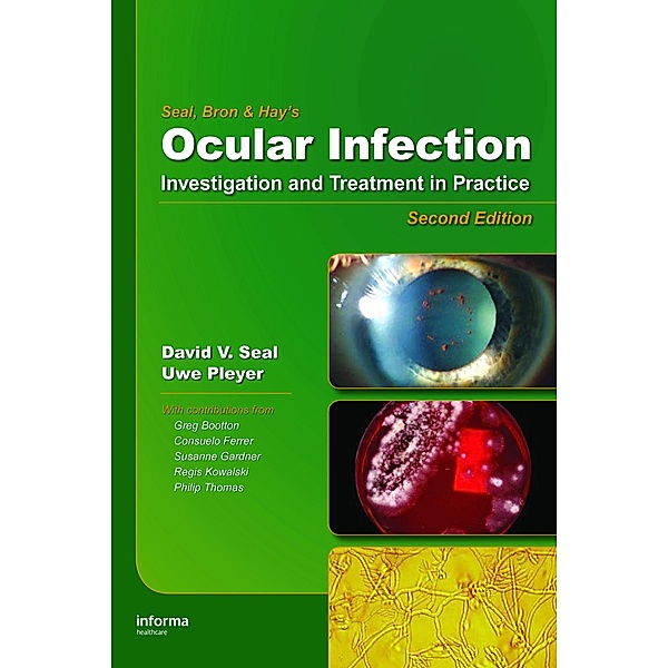 Ocular Infection, David V. Seal, Uwe Pleyer